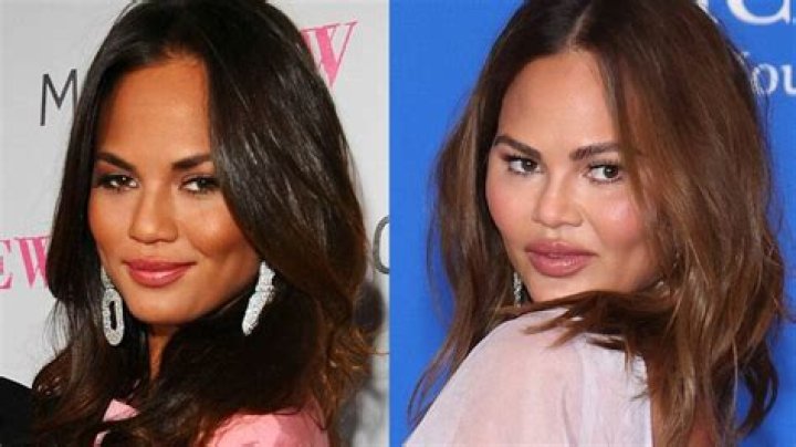 Chrissy Teigen: Details About HerAge and Rumors of Plastic Surgery - SarkariResult