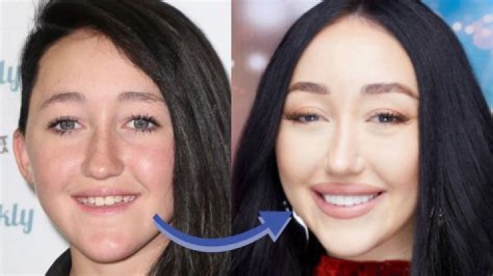Fact Check: Is Noah Cyrus Asian? Before And After Photos -Everything On Her Mom And More