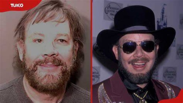 Hank Williams Jr Without Hat And Sunglasses After Facial Injuries From Accident