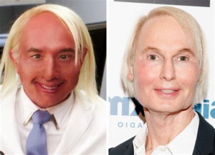 Has Martin Short Done Plastic Surgery? Before And After Photos