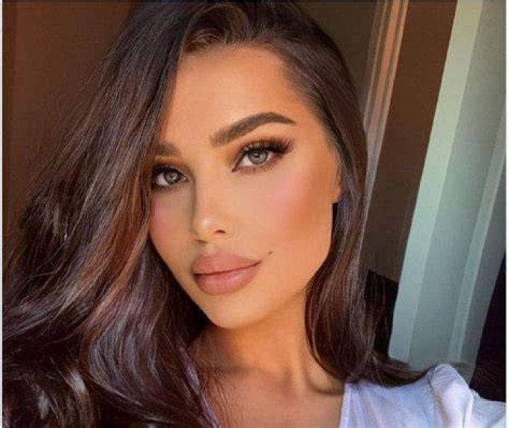 Ines Helene Before Plastic Surgery | Botox And Lip Filler