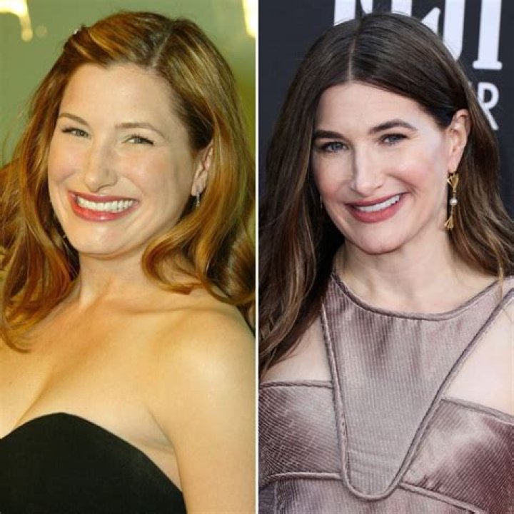 Kathryn Hahn Nose Surgery: Before And After Photo