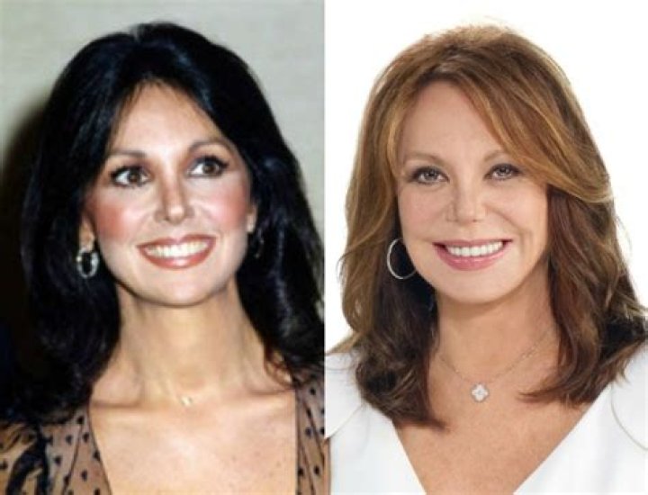 Marlo Thomas Plastic Surgery: What Happened To Her Face?