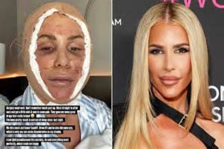 Tracy Tutor’s Plastic Surgery: Million Dollar Listing Star’s Cosmetic Alterations Explored!