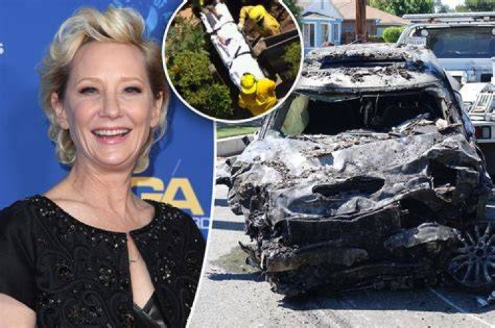 
What exactly are thermal wounds? Days after a catastrophic vehicle crash, Anne Heche’s cause of death was made public. 