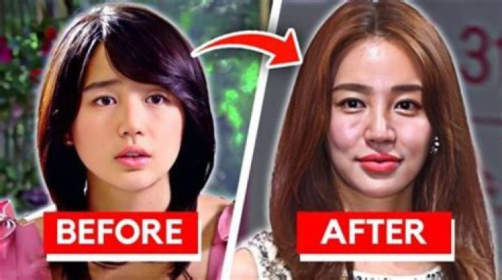 What Happened To Betsy Woodruff Face? Did She Undergo Jaw Surgery?