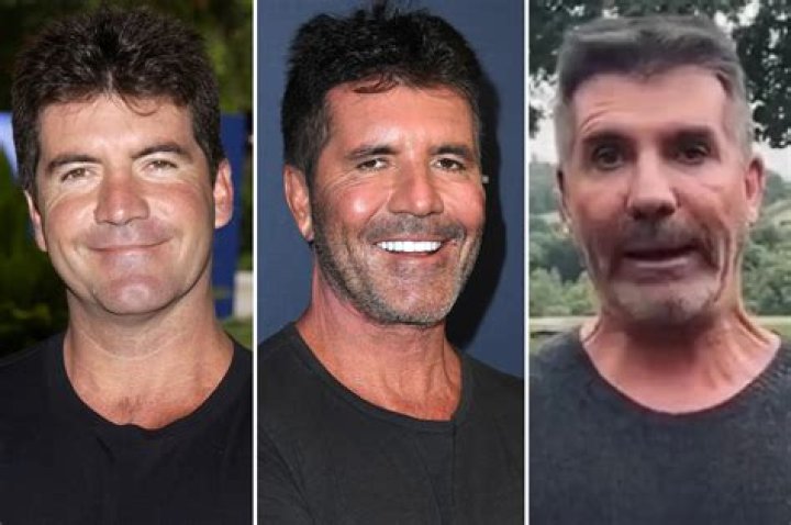 What Happened To Simon Cowell’s Face? Fans Concerned With His Disappearing Eyes