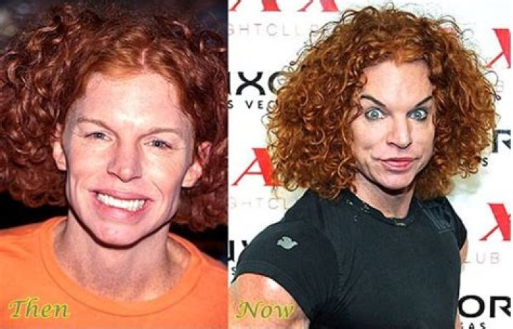 Who is Carrot Top? Has Carrot Top Had Plastic Surgery? Who is Carrot Top? Know All About Him - SarkariResult