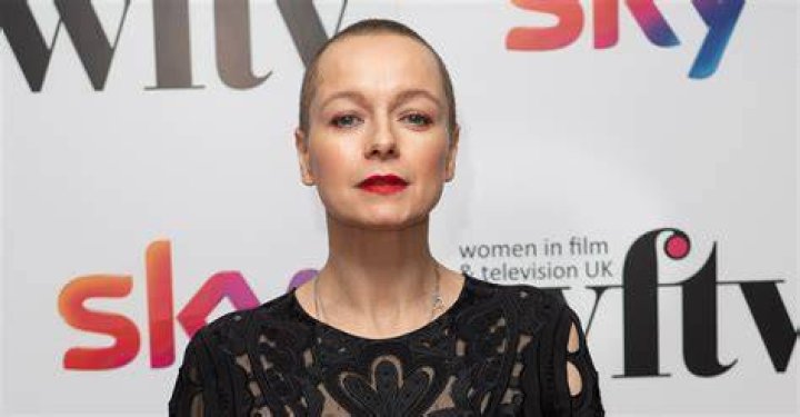 Why Is Samantha Morton Bald? Actress Health Related Problems And Short Hair Details